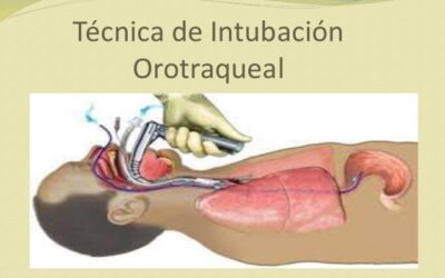 PERSONAS QUE «ESTABAN BIEN» Y EN CUESTIÓN DE HORAS O UN DÍA HAN NECESITADO SER ENTUBADAS PORQUE NO PODÍAN RESPIRAR
